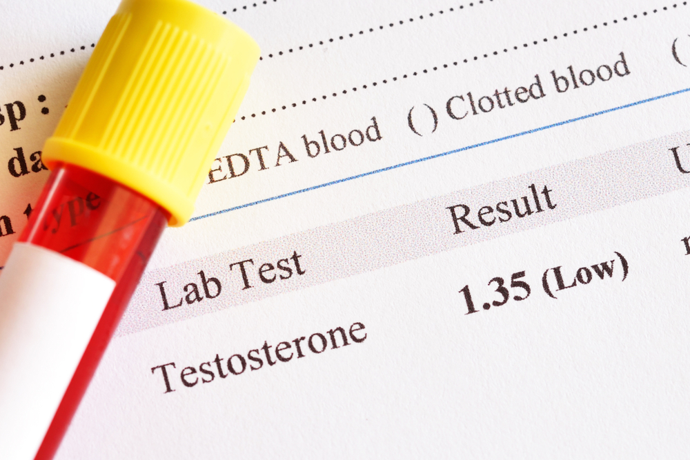 Abnormal,Low,Testosterone,Hormone,Test,Result,With,Blood,Sample,Tube